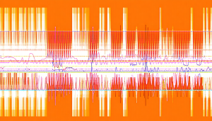 Les parasites radio peuvent transformer une simple session d&rsquo;écoute radio ou l&rsquo;utilisation d&rsquo;un dispositif électrique en une source de frustration intense. Et face à un gradateur mal filtré, ces interférences peuvent rapidement dégénérer en un cauchemar. Heureusement, des solutions existent [&hellip;]